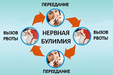 Лечение булимии в Кусе